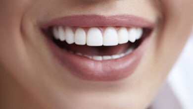 دندان‌ سفید